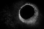 Black hole